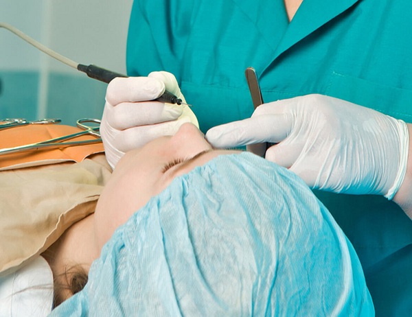 Cirugía Facial
