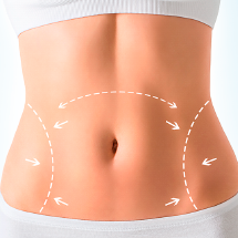 Dermolipectomía Abdominal (Abdominoplastia / Tummy Tuck)