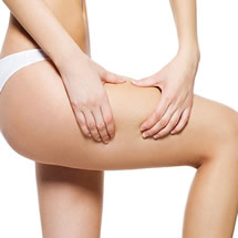 Elevación de Muslos (Cruroplastia / Lifting de Muslos)