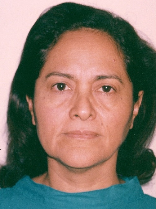 Estiramiento de Frente (Frontoplastia / Lifting Frontal) - Antes