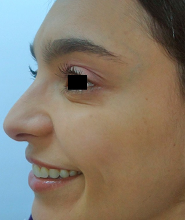 Medicina Cosmética y Estética Facial Avanzada - Después